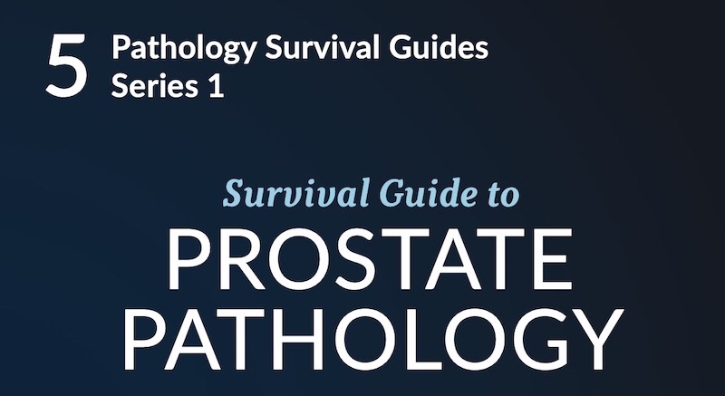 Survival Guide To Prostate Pathology Sociedad Latinoamericana De